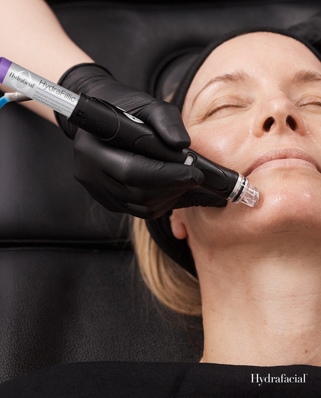 HydraFacial treatment for bridal skin prep